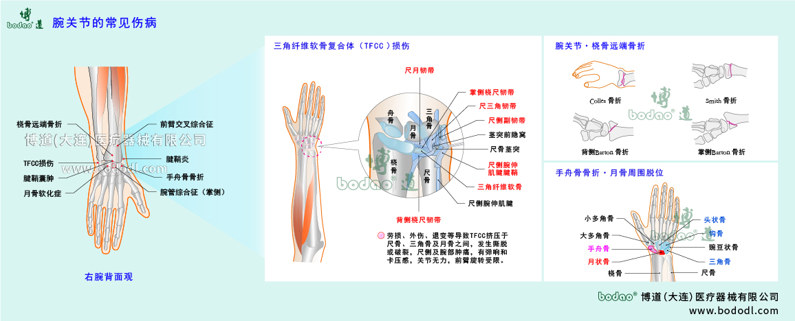 腕關節(jié)傷病的類型與癥狀