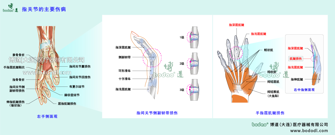 指關(guān)節(jié)傷病的類(lèi)型與癥狀