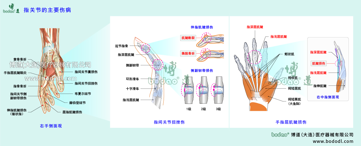 指關(guān)節(jié)傷病的類型與癥狀