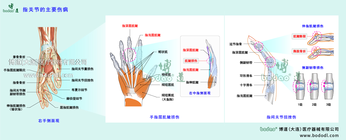 指關節(jié)傷病的類型與癥狀